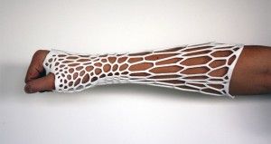Una férula impresa en 3D que ayudará a sanar tu brazo roto