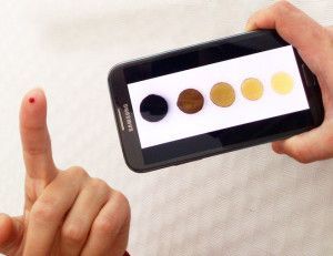samsunganemia