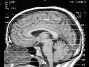 brain