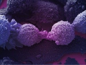 Combatir el cáncer usando nuestras propias defensas ya es posible