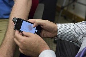 Crean aplicación para iPhone que detecta el cáncer a la piel DermoScan