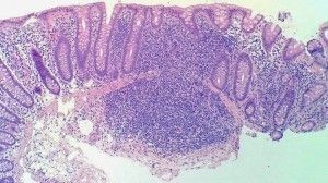 La cámara del Lumia 1020 también sirve para fotografiar microbios