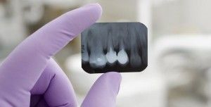 Descubren una forma de hacer que renazcan dientes perdidos